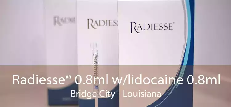 Radiesse® 0.8ml w/lidocaine 0.8ml Bridge City - Louisiana