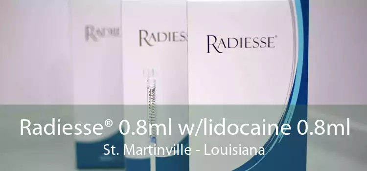 Radiesse® 0.8ml w/lidocaine 0.8ml St. Martinville - Louisiana
