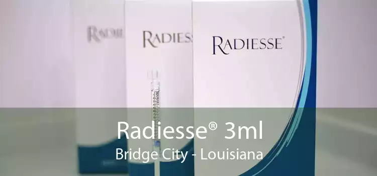 Radiesse® 3ml Bridge City - Louisiana